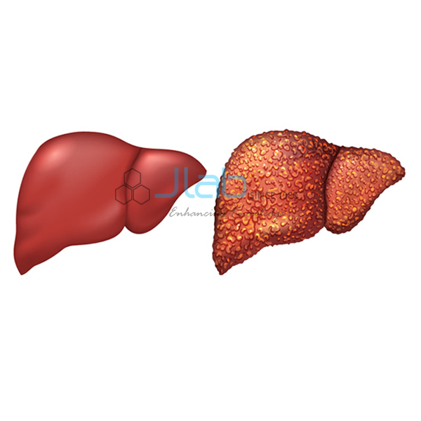 Cirrhosis Liver Model Manufacturer And Supplier In India Albania