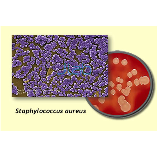 Staphylococcus aureus 3