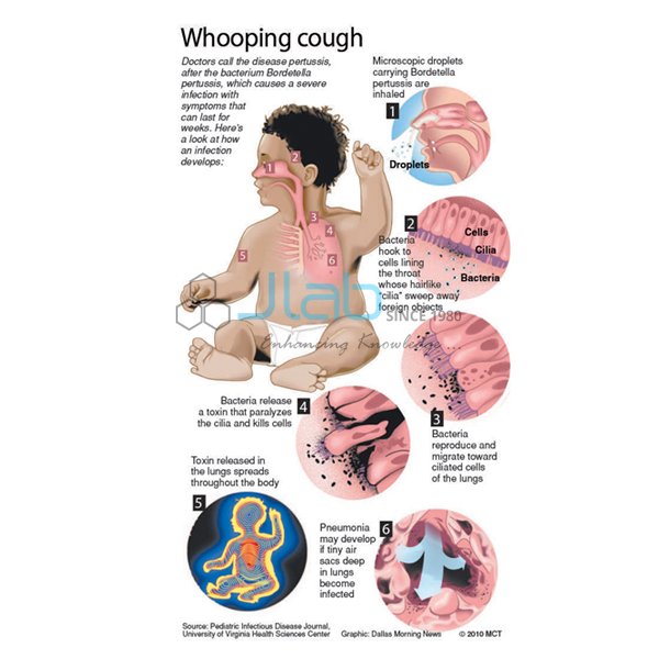 Bordetella Pertussis and Disease Model
