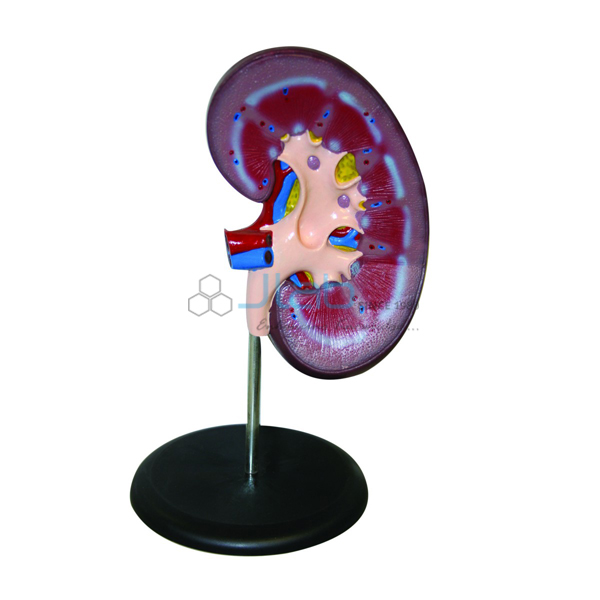 Kidney Model