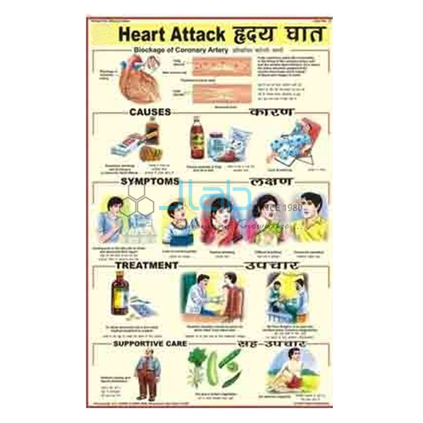 Heart Attack Chart