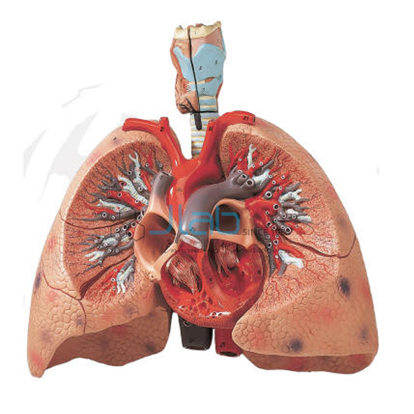 Heart with Lungs and Larynx