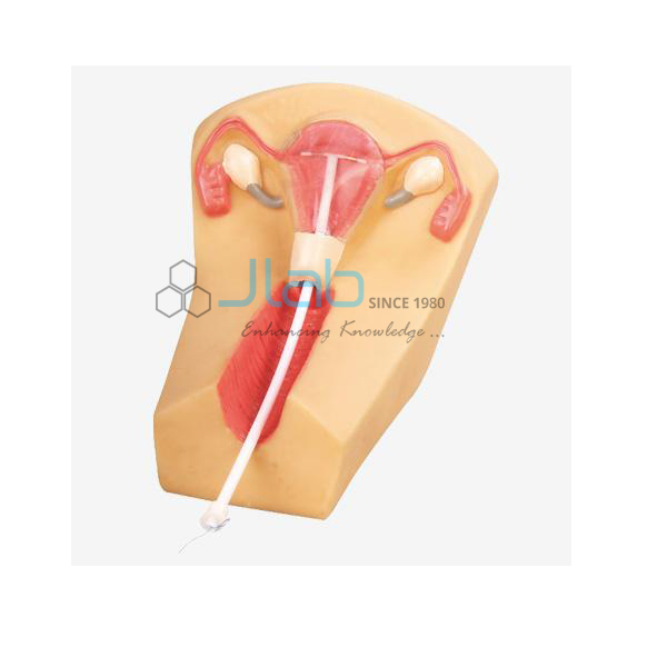 IUD Training Model