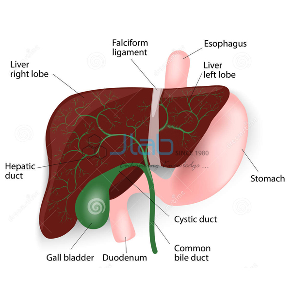 Cholalithiasis Gall Stone Model