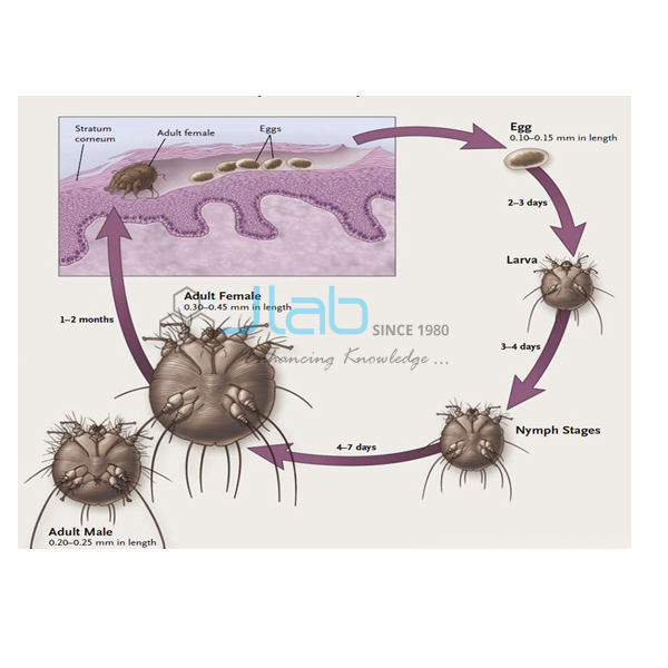 Life Cycle of Scabies Model India, Life Cycle of Scabies 