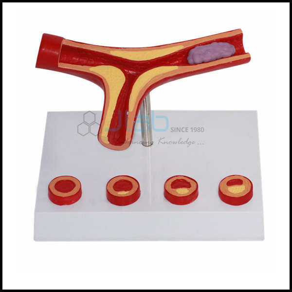 Arteries with Heart Models