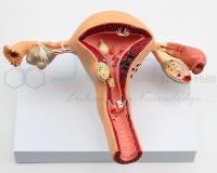 Uterus Model