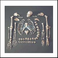 Disarticulated Human Skeleton 200 Bones