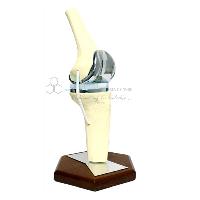 Knee Implant Model