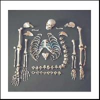 Human Skeleton Dis-articulated