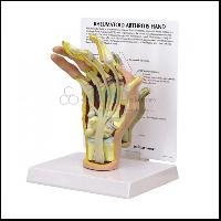 Hand Arthritis Model