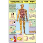 Hemorrhage Chart